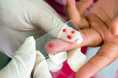 Diagnosis of pain in the finger joints
