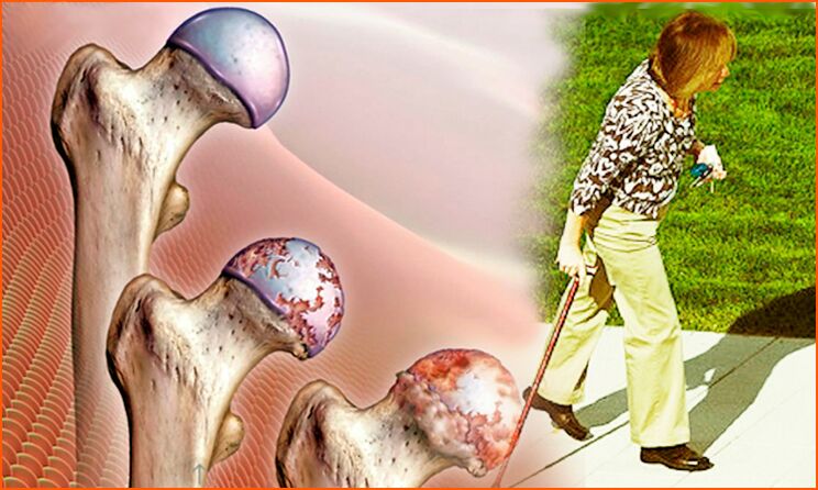 Continuous lameness in the last stage of hip joint arthrosis
